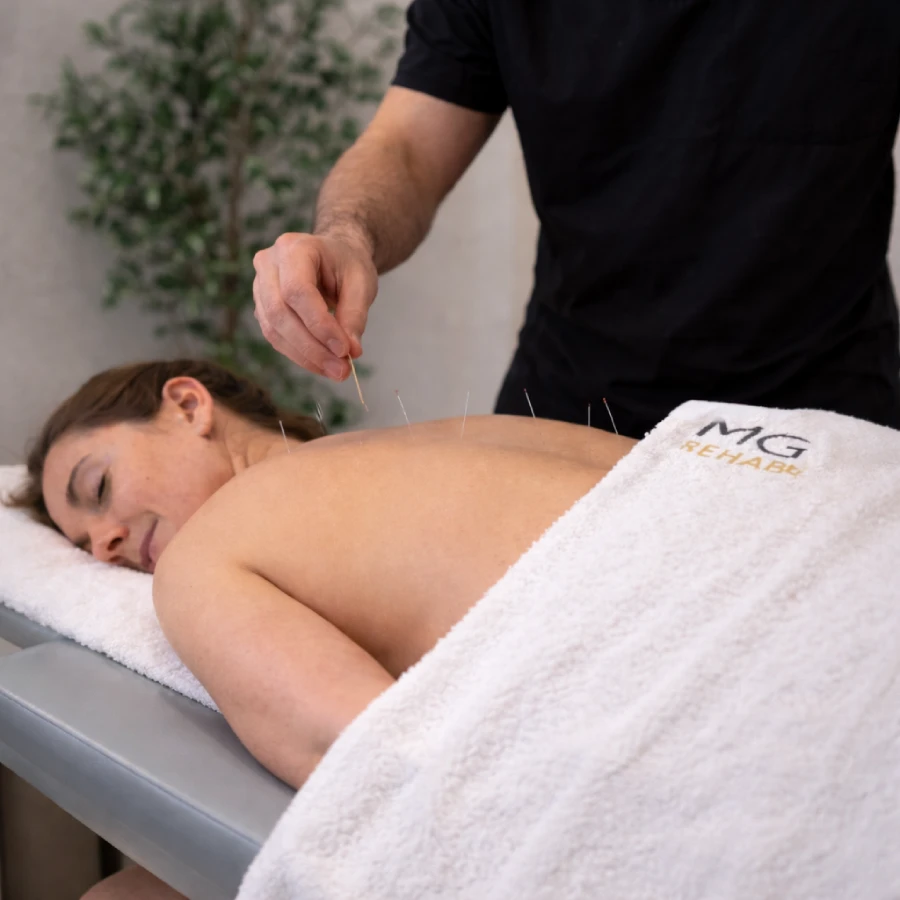 Acupuncture treatment in Richmond at MG Rehab clinic